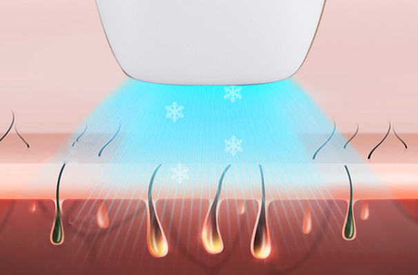 Un Poco Acerca de la Depilación Láser